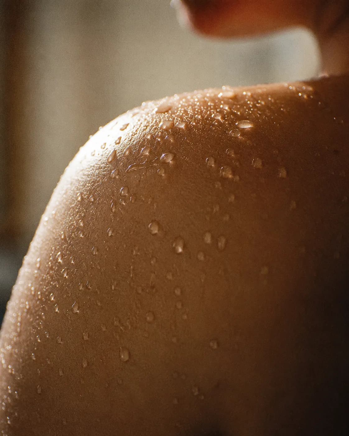 A freckled side profile with fine water beads sitting on the cheek, skin reading hydrated and lit.